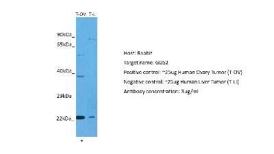 Western Blot: GliS2 Antibody [NBP2-84979]