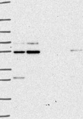 Western Blot: GliS2 Antibody [NBP3-17373]