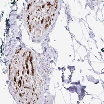 Immunohistochemistry-Paraffin: Gliomedin Antibody [NBP2-38873]