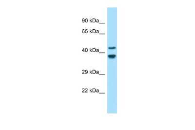 Western Blot: Gliomedin Antibody [NBP2-84974]