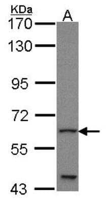 Western Blot: Glis1 Antibody [NBP1-31273]