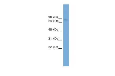 Western Blot: Glis1 Antibody [NBP3-10440]