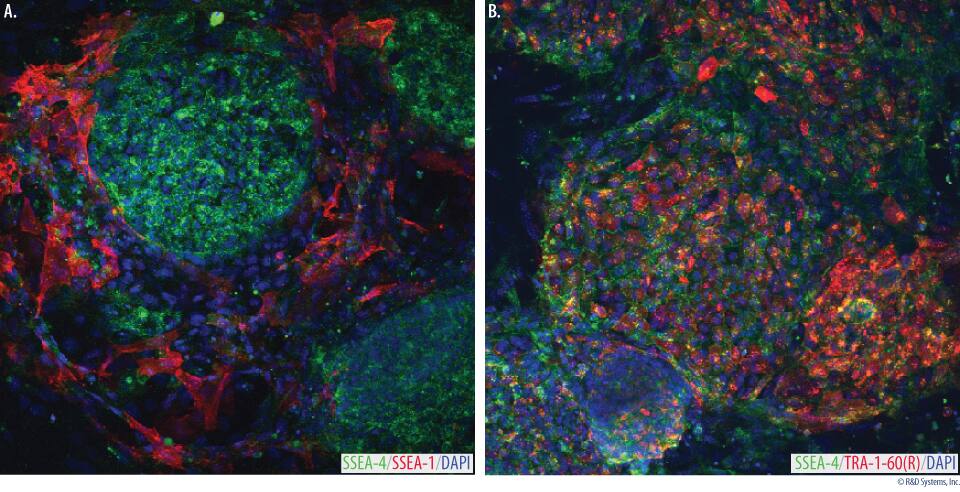 Verification of Pluripotency in Human Induced Pluripotent Stem Cells.