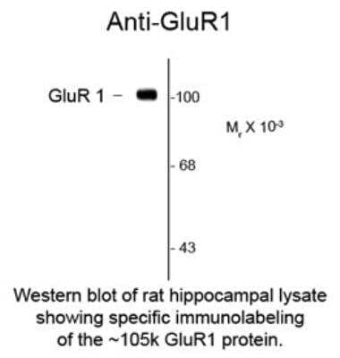 Western Blot: GluR1 Antibody (RH95) [NBP2-29534]