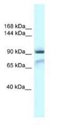 Western Blot: GluR1 Antibody [NBP1-82396]