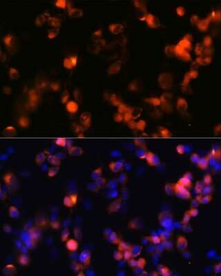 Immunocytochemistry/ Immunofluorescence: GluR2 Antibody (9R1X2) [NBP3-15370]