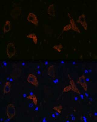 Immunohistochemistry: GluR2 Antibody (9R1X2) [NBP3-15370]