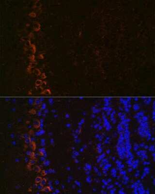 Immunohistochemistry: GluR2 Antibody (9R1X2) [NBP3-15370]