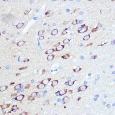 Immunohistochemistry-Paraffin: GluR2 Antibody (9R1X2) [NBP3-15370]