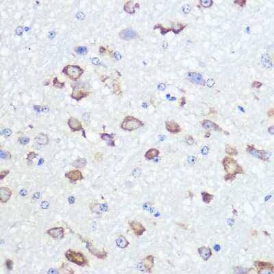 Immunohistochemistry-Paraffin: GluR2 Antibody (9R1X2) [NBP3-15370]