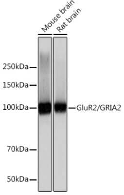 Western Blot: GluR2 Antibody (9R1X2) [NBP3-15370]