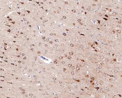 Immunohistochemistry-Paraffin: GluR2 Antibody (JU20-43) [NBP2-75510]