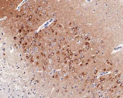 Immunohistochemistry-Paraffin: GluR2 Antibody (JU20-43) [NBP2-75510]