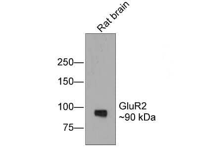 Western Blot: GluR2 Antibody (JU20-43) [NBP2-75510]