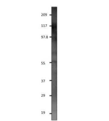 Western Blot: GluR5/GRIK1 Antibody [NBP3-12471]