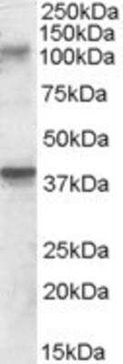 Western Blot: GluR7/GRIK3 Antibody [NBP1-20930]