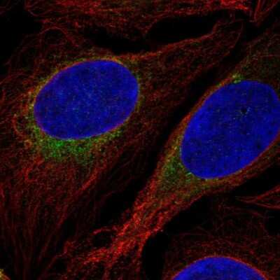 Immunocytochemistry/ Immunofluorescence: Glucagon Antibody [NBP2-38329]