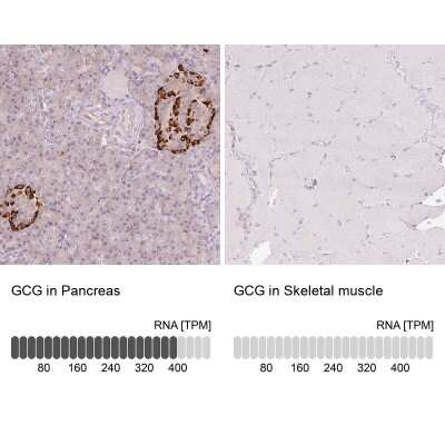 Immunohistochemistry-Paraffin: Glucagon Antibody [NBP2-38329]