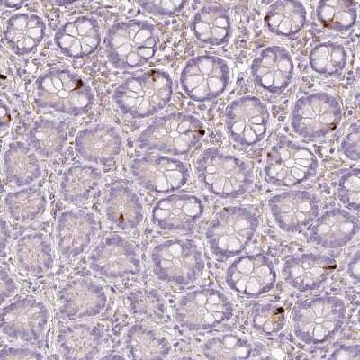 Immunohistochemistry-Paraffin: Glucagon Antibody [NBP2-38329]
