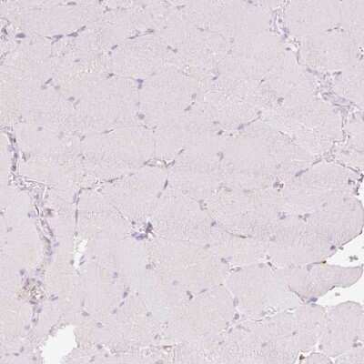 Immunohistochemistry-Paraffin: Glucagon Antibody [NBP2-38329]