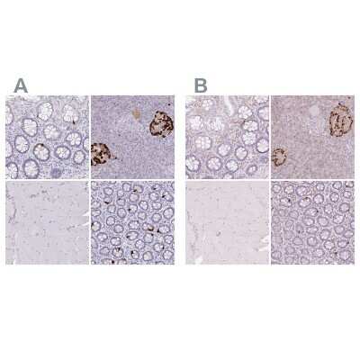 Immunohistochemistry-Paraffin: Glucagon Antibody [NBP2-38330]