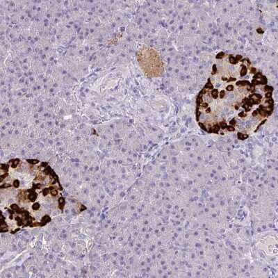 Immunohistochemistry-Paraffin: Glucagon Antibody [NBP2-38330]