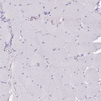 Immunohistochemistry-Paraffin: Glucagon Antibody [NBP2-38330]