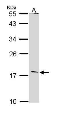 Western Blot: Glucagon Antibody [NBP2-16672]