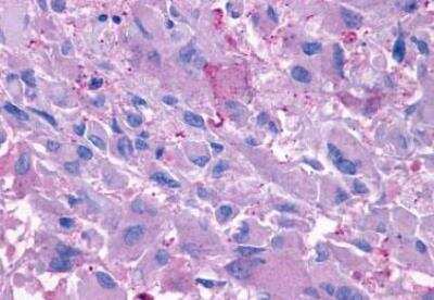 Immunohistochemistry-Paraffin: Glucagon R/GCGR Antibody - BSA Free [NLS4257]