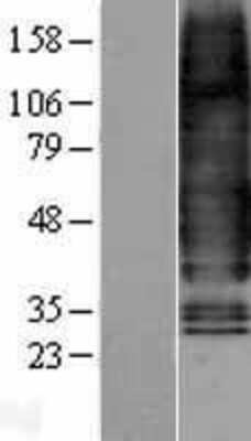 Western Blot: Glucagon R/GCGR Overexpression Lysate [NBL1-11006]