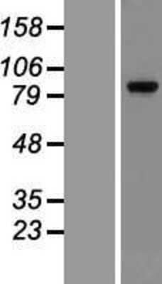 Western Blot: GR/NR3C1 Overexpression Lysate [NBP2-11020]