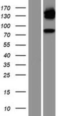 Western Blot: GR/NR3C1 Overexpression Lysate [NBP2-11025]