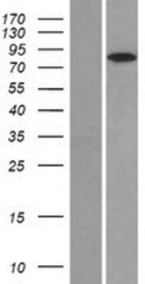 Western Blot: GR/NR3C1 Overexpression Lysate [NBP2-11155]