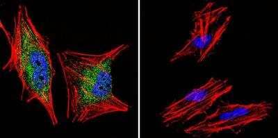 Immunocytochemistry/ Immunofluorescence: Glucocorticoid Receptor alpha Antibody - BSA Free [NB300-633]