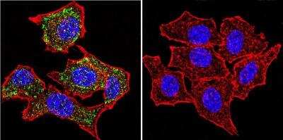 Immunocytochemistry/ Immunofluorescence: Glucocorticoid Receptor alpha Antibody - BSA Free [NB300-633]