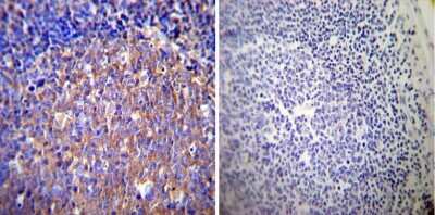 Immunohistochemistry-Paraffin: Glucocorticoid Receptor alpha Antibody - BSA Free [NB300-633]