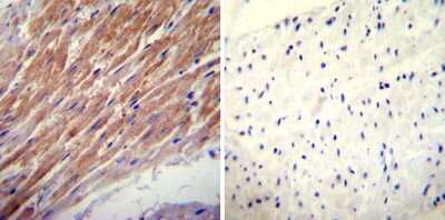Immunohistochemistry-Paraffin: Glucocorticoid Receptor alpha Antibody - BSA Free [NB300-633]