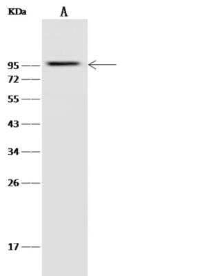 Western Blot: Glucokinase/GCK Antibody (223) [NBP2-89787]