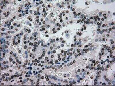 Immunohistochemistry-Paraffin: Glucokinase/GCK Antibody (OTI3E3) [NBP1-47778]