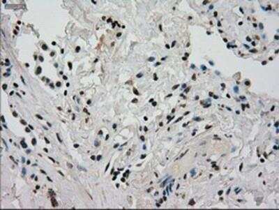 Immunohistochemistry-Paraffin: Glucokinase/GCK Antibody (OTI3E3) [NBP1-47778]