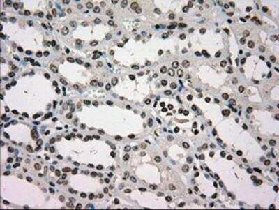 Immunohistochemistry-Paraffin: Glucokinase/GCK Antibody (OTI3E3) [NBP1-47778]