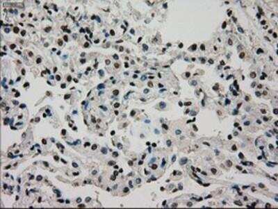 Immunohistochemistry-Paraffin: Glucokinase/GCK Antibody (OTI3E3) [NBP1-47778]