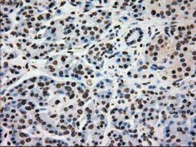 Immunohistochemistry-Paraffin: Glucokinase/GCK Antibody (OTI3E3) [NBP1-47778]