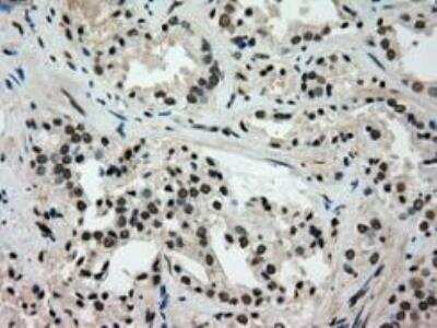 Immunohistochemistry-Paraffin: Glucokinase/GCK Antibody (OTI3E3) [NBP1-47778]