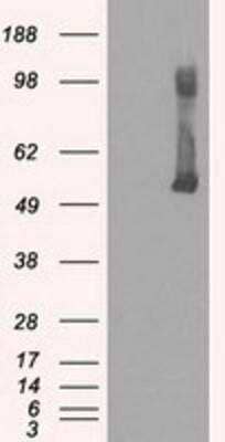 Western Blot: Glucokinase/GCK Antibody (OTI3E3) [NBP1-47778]