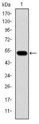 Western Blot: Glucokinase/GCK Antibody (4G6)BSA Free [NBP2-37579]