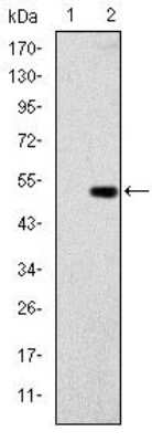 Western Blot: Glucokinase/GCK Antibody (4G6)BSA Free [NBP2-37579]