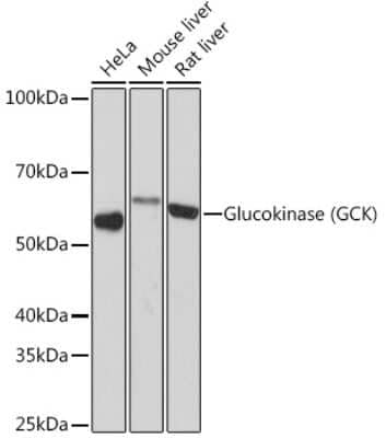 Western Blot: Glucokinase/GCK Antibody (4K9D5) [NBP3-16579]