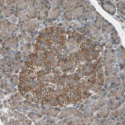 Immunohistochemistry-Paraffin: Glucokinase/GCK Antibody [NBP1-81742]