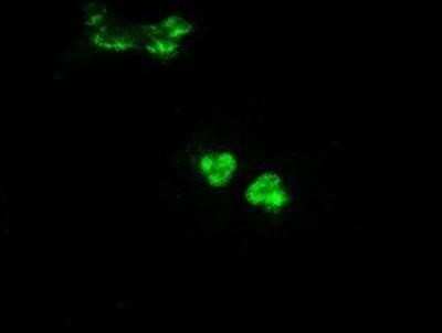 Immunocytochemistry/ Immunofluorescence: Glucokinase/GCK Antibody (OTI3E3) - Azide and BSA Free [NBP2-70822]